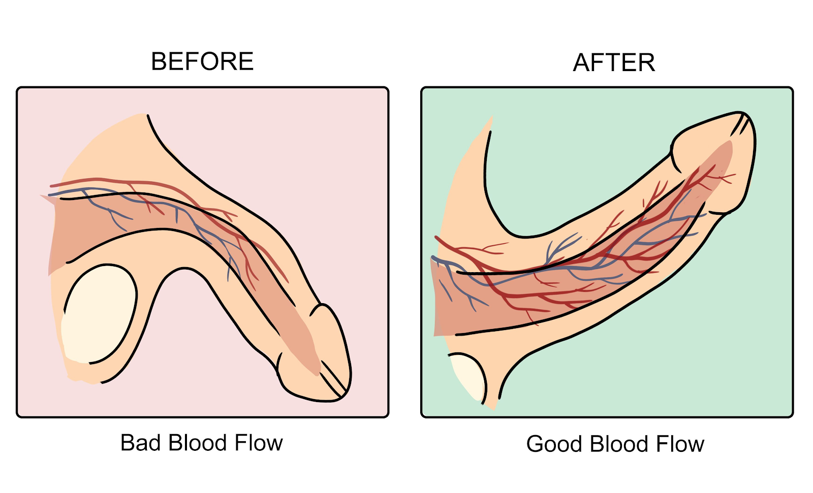 Libido Leeches Illustration